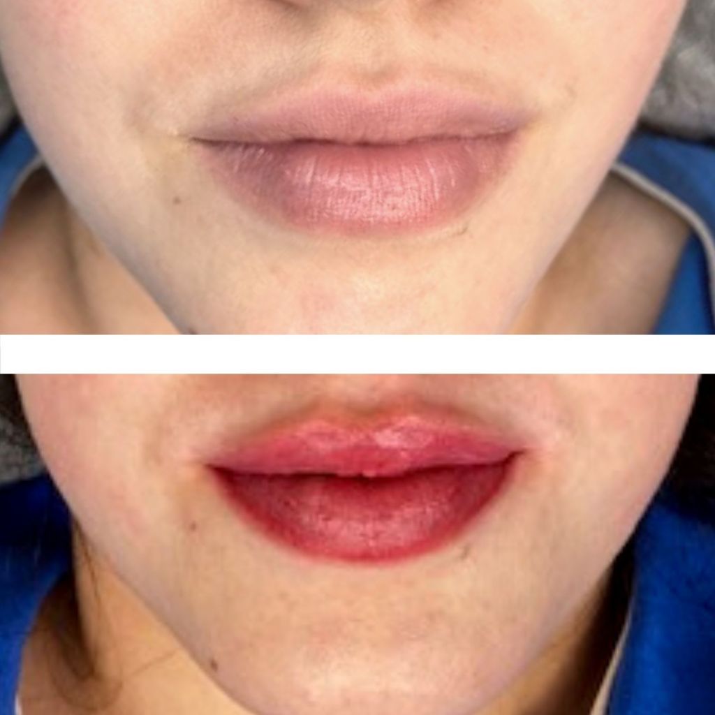 Lip Blush Tattoo Everything You Need to Know About Lip Blushing