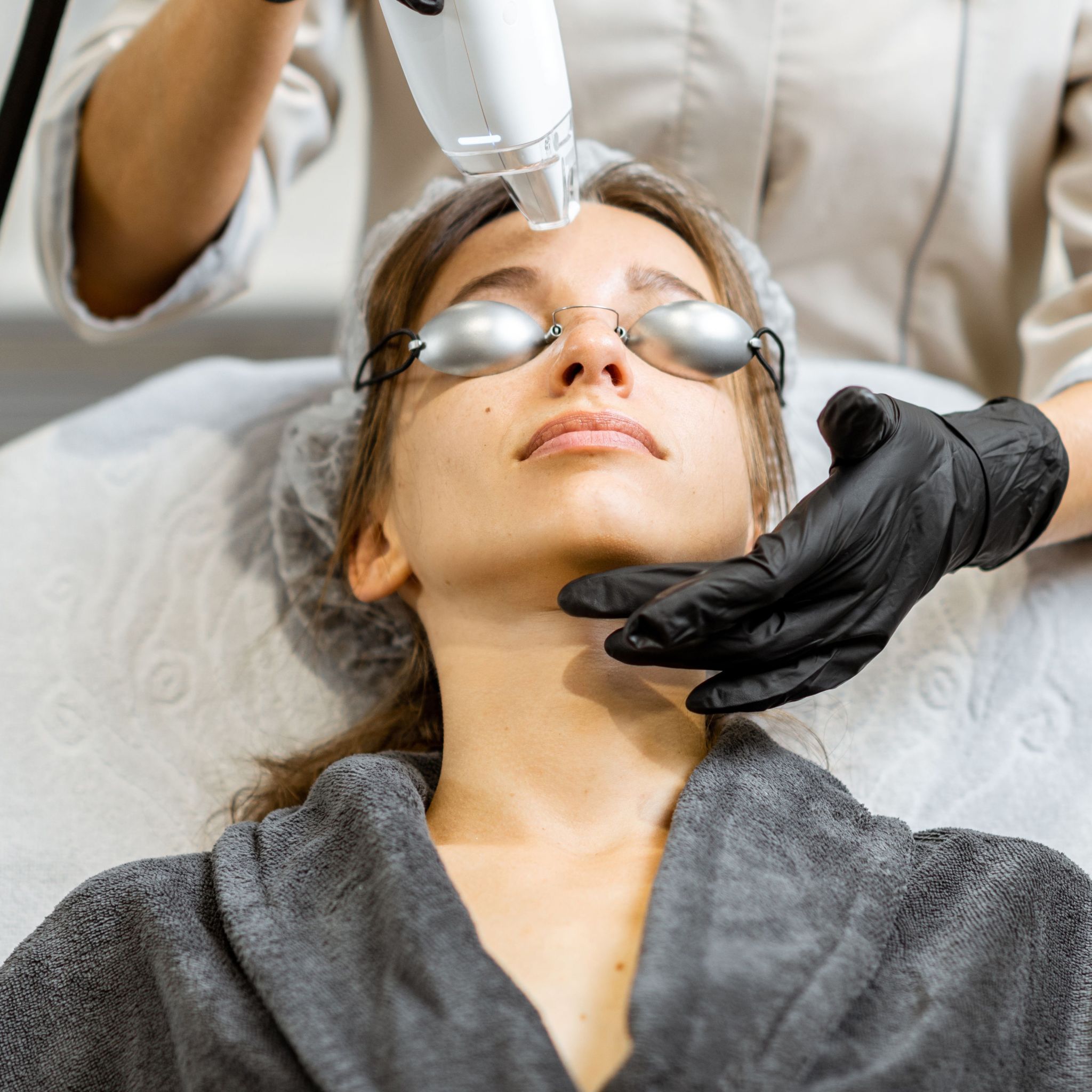 Rosacea & Broken Capillaries on Face IPL & Laser Facial Treatment